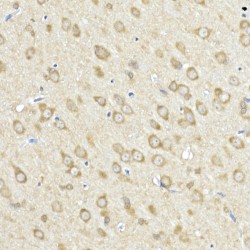 Acyl-CoA Synthetase Long Chain Family Member 4 (ACSL4) Antibody