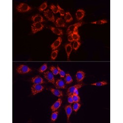Acyl-CoA Synthetase Long Chain Family Member 4 (ACSL4) Antibody