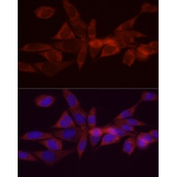 Diacylglycerol O-Acyltransferase 1 (DGAT1) Antibody