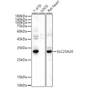 Western blot analysis of various lysates using SLC25A20 Antibody at 1/500 dilution. Secondary antibody: HRP-conjugated Goat anti-Rabbit IgG (H+L) at 1/10000 dilution. Lysates/proteins: 25 µg per lane. Blocking buffer: 3% nonfat dry milk in TBST. Exposure time: 60s.
