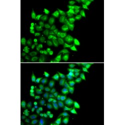 Mesoderm-Specific Transcript Homolog Protein (MEST) Antibody