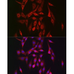 Protein Kinase, AMP Activated Beta 2 (PRKAB2) Antibody