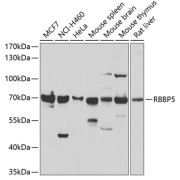 Western blot analysis of various lysates using RBBP5 Antibody at 1/1000 dilution. Secondary antibody: HRP-conjugated Goat anti-Rabbit IgG (H+L) at 1/10000 dilution. Lysates/proteins: 25 µg per lane. Blocking buffer: 3% nonfat dry milk in TBST. Exposure time: 10s.