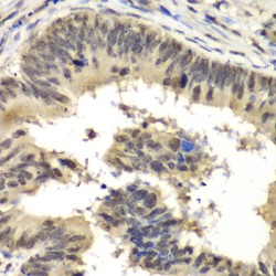Histone-Binding Protein RBBP5 (RBBP5) Antibody