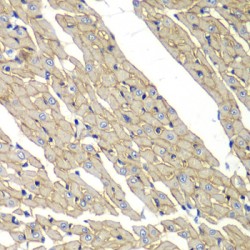 Sarcoglycan Delta (SGCD) Antibody