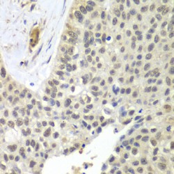 Small Nuclear Ribonucleoprotein D2 Polypeptide (SNRPD2) Antibody