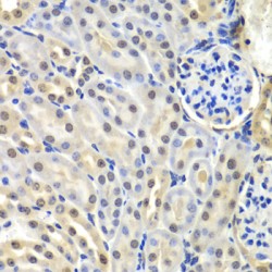 Small Nuclear Ribonucleoprotein D2 Polypeptide (SNRPD2) Antibody