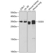 Western blot analysis of various lysates using SOD3 Antibody at 1/1000 dilution. Secondary antibody: HRP-conjugated Goat anti-Rabbit IgG (H+L) at 1/10000 dilution. Lysates/proteins: 25 µg per lane. Blocking buffer: 3% nonfat dry milk in TBST.