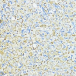 Superoxide Dismutase 3 (SOD3) Antibody