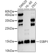 Western blot analysis of various lysates using SSBP1 Antibody at 1/500 dilution. Secondary antibody: HRP-conjugated Goat anti-Rabbit IgG (H+L) at 1/10000 dilution. Lysates/proteins: 25 µg per lane. Blocking buffer: 3% nonfat dry milk in TBST. Exposure time: 30s.
