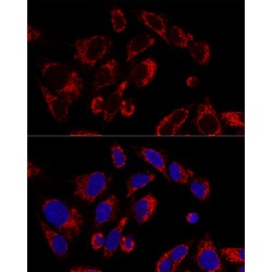 Single Stranded DNA Binding Protein 1 (SSBP1) Antibody