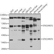 Western blot analysis of various lysates using STK3/MST2 Antibody at 1/1000 dilution. Secondary antibody: HRP-conjugated Goat anti-Rabbit IgG (H+L) at 1/10000 dilution. Lysates/proteins: 25 µg per lane. Blocking buffer: 3% nonfat dry milk in TBST. Exposure time: 60s.