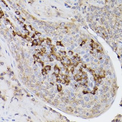 Mesencephalic Astrocyte Derived Neurotrophic Factor (MANF) Antibody