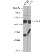 Western blot analysis of various lysates using HYAL3 Antibody at 1/1000 dilution. Secondary antibody: HRP-conjugated Goat anti-Rabbit IgG (H+L) at 1/10000 dilution. Lysates/proteins: 25 µg per lane. Blocking buffer: 3% nonfat dry milk in TBST. Exposure time: 30s.