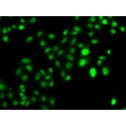 Protein CBFA2T2 (CBFA2T2) Antibody