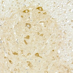 Coatomer Protein Complex Subunit Beta 2 (COPB2) Antibody