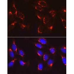Coatomer Protein Complex Subunit Beta 2 (COPB2) Antibody