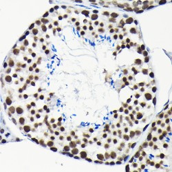 Elongation Factor Tu GTP-Binding Domain-Containing Protein 2 (EFTUD2) Antibody