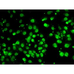 QKI, KH Domain Containing RNA Binding (QKI) Antibody