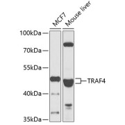 Western blot analysis of various lysates using TRAF4 Antibody at 1/1000 dilution. Secondary antibody: HRP-conjugated Goat anti-Rabbit IgG (H+L) at 1/10000 dilution. Lysates/proteins: 25 µg per lane. Blocking buffer: 3% nonfat dry milk in TBST. Exposure time: 30s.