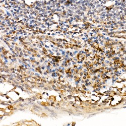 TNF Receptor-Associated Factor 4 (TRAF4) Antibody