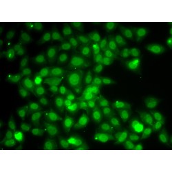 TNF Receptor-Associated Factor 4 (TRAF4) Antibody