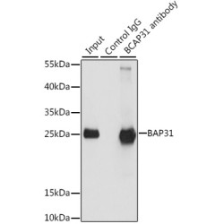 B-Cell Receptor-Associated Protein 31 (BCAP31) Antibody