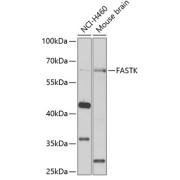 Western blot analysis of various lysates using FASTK Antibody at 1/1000 dilution. Secondary antibody: HRP-conjugated Goat anti-Rabbit IgG (H+L) at 1/10000 dilution. Lysates/proteins: 25 µg per lane. Blocking buffer: 3% nonfat dry milk in TBST. Exposure time: 90s.