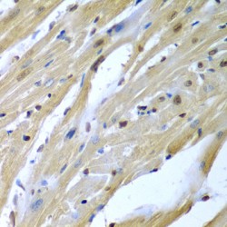 Tumor Suppressor Candidate 2 (TUSC2) Antibody