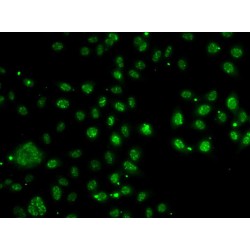Low Density Lipoprotein Receptor Adaptor Protein 1 (LDLRAP1) Antibody