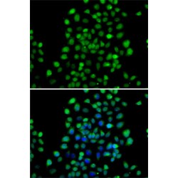 N-Terminal Xaa-Pro-Lys N-Methyltransferase 1 (NTMT1) Antibody