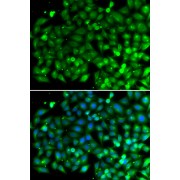 Immunofluorescence analysis of A549 cells using Bif-1 Antibody. Secondary antibody: Cy3-conjugated Goat anti-Rabbit IgG (H+L) at 1/500 dilution. Blue: DAPI for nuclear staining.