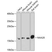 Western blot analysis of various lysates using NAA20 Antibody at 1/1000 dilution. Secondary antibody: HRP-conjugated Goat anti-Rabbit IgG (H+L) at 1/10000 dilution. Lysates/proteins: 25 µg per lane. Blocking buffer: 3% nonfat dry milk in TBST. Exposure time: 90s.