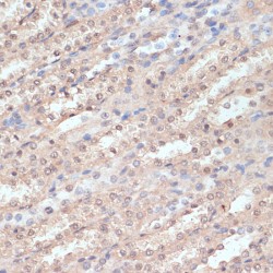 N-Alpha-Acetyltransferase 20 (NAA20) Antibody