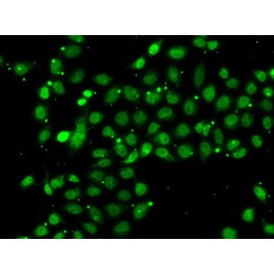 Actin-Like Protein 6B (ACTL6B) Antibody
