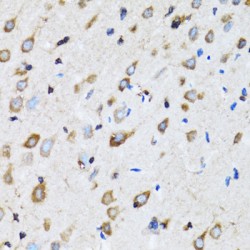 NudE Neurodevelopment Protein 1 (NDE1) Antibody