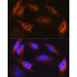Alsin (ALS2) Antibody