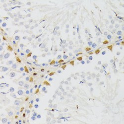 Zinc Phosphodiesterase ELAC Protein 2 (ELAC2) Antibody
