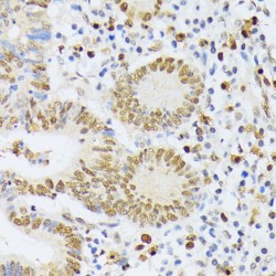 Zinc Phosphodiesterase ELAC Protein 2 (ELAC2) Antibody