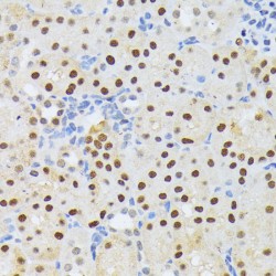 Zinc Phosphodiesterase ELAC Protein 2 (ELAC2) Antibody
