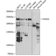 Western blot analysis of various lysates using THADA Antibody at 1/1000 dilution. Secondary antibody: HRP-conjugated Goat anti-Rabbit IgG (H+L) at 1/10000 dilution. Lysates/proteins: 25 µg per lane. Blocking buffer: 3% nonfat dry milk in TBST. Exposure time: 90s.