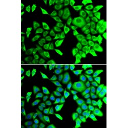 THADA, Armadillo Repeat Containing (THADA) Antibody