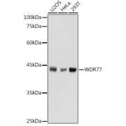 Western blot analysis of various lysates using WDR77 Antibody at 1/1000 dilution. Secondary antibody: HRP-conjugated Goat anti-Rabbit IgG (H+L) at 1/10000 dilution. Lysates/proteins: 25 µg per lane. Blocking buffer: 3% nonfat dry milk in TBST. Exposure time: 1s.