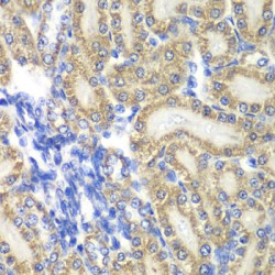 Prostaglandin E Synthase 2 (PTGES2) Antibody