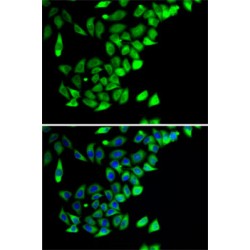 Prostaglandin E Synthase 2 (PTGES2) Antibody