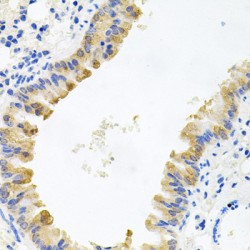 Alkylated DNA Repair Protein AlkB Homolog 8 (ALKBH8) Antibody