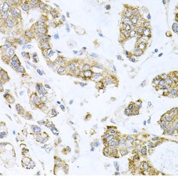 Alkylated DNA Repair Protein AlkB Homolog 8 (ALKBH8) Antibody