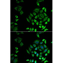 Phospholipase A2, Group II D (PLA2G2D) Antibody