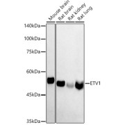 Western blot analysis of various lysates using ETV1 Antibody at 1/1000 dilution. Secondary antibody: HRP-conjugated Goat anti-Rabbit IgG (H+L) at 1/10000 dilution. Lysates/proteins: 25 µg per lane. Blocking buffer: 3% nonfat dry milk in TBST. Exposure time: 180s.