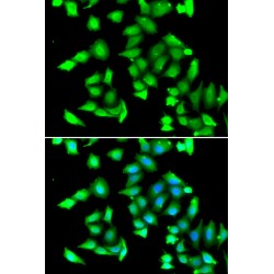 Glutathione S Transferase C-Terminal Domain Containing Protein (GSTCD) Antibody